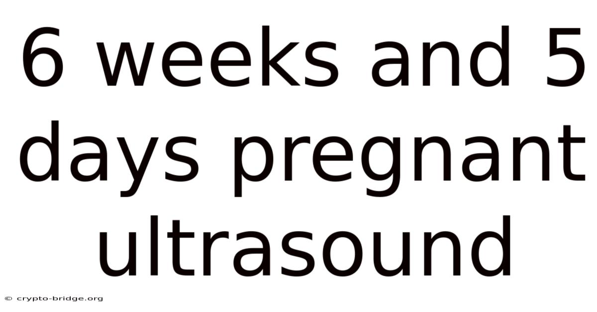 6 Weeks And 5 Days Pregnant Ultrasound