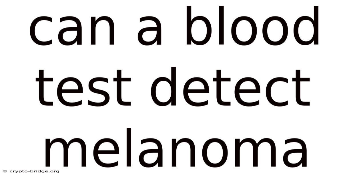 Can A Blood Test Detect Melanoma