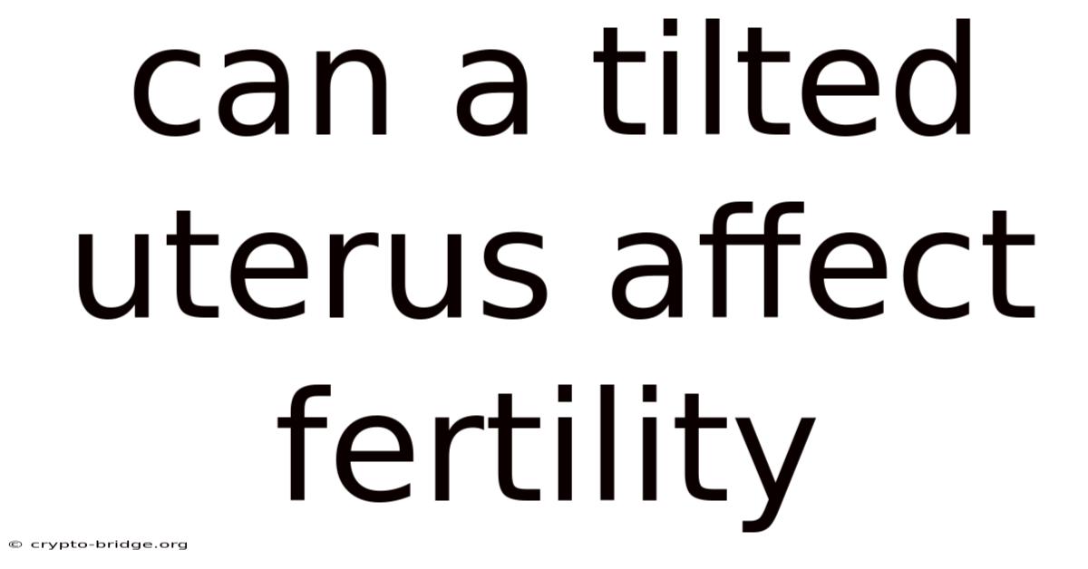Can A Tilted Uterus Affect Fertility