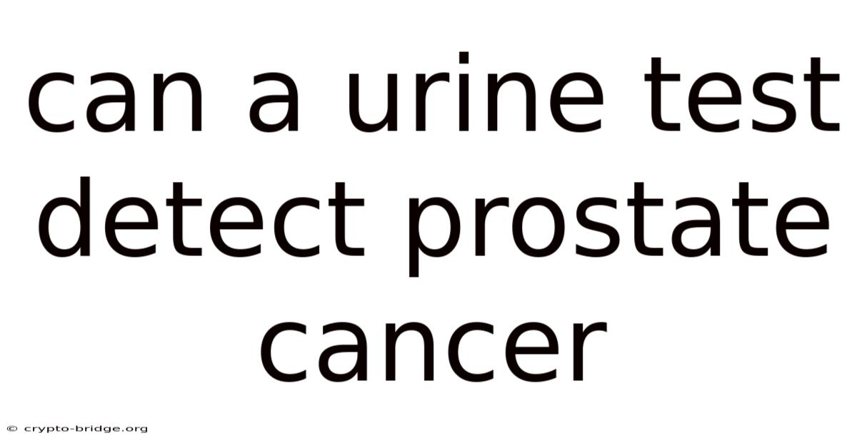 Can A Urine Test Detect Prostate Cancer