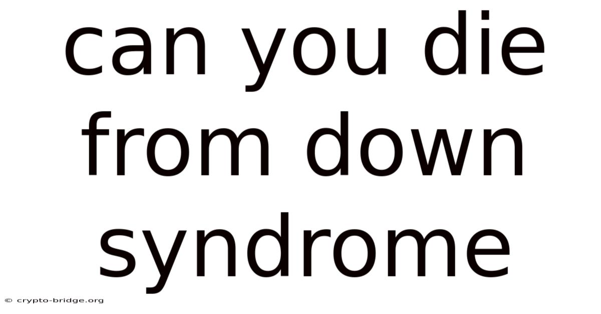 Can You Die From Down Syndrome