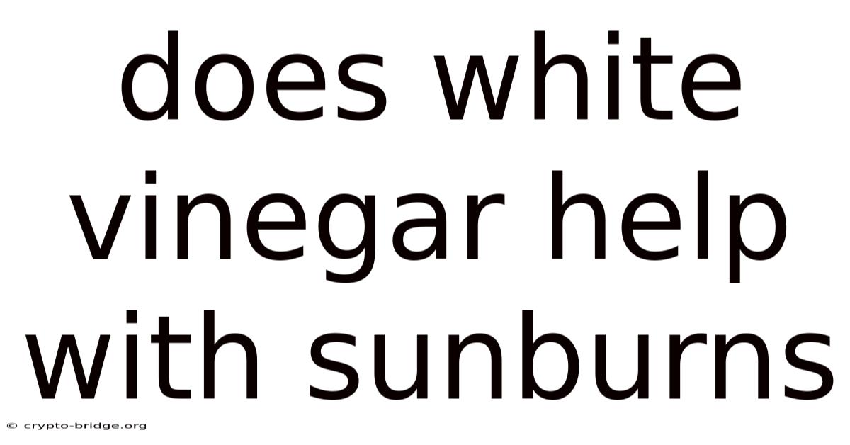 Does White Vinegar Help With Sunburns