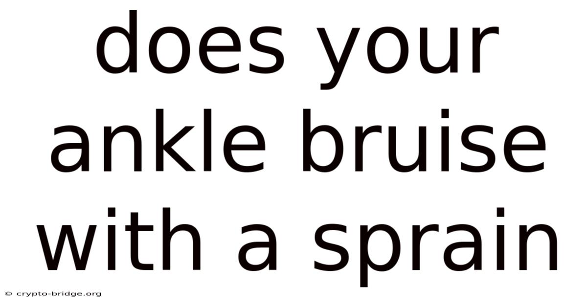 Does Your Ankle Bruise With A Sprain