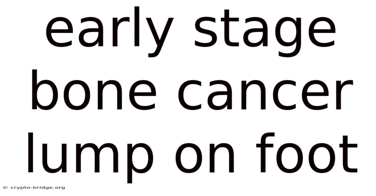 Early Stage Bone Cancer Lump On Foot
