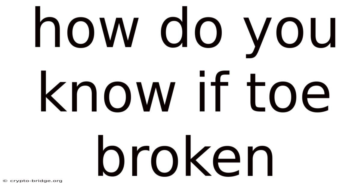 How Do You Know If Toe Broken
