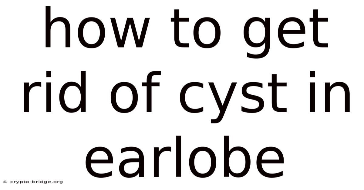 How To Get Rid Of Cyst In Earlobe
