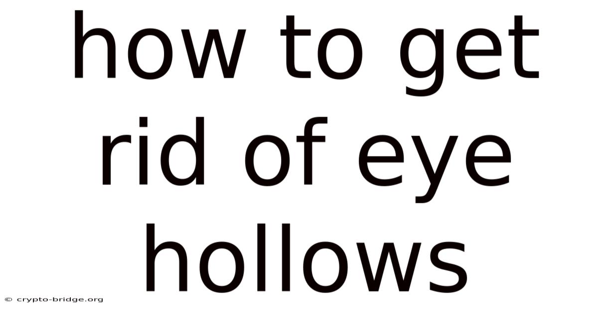 How To Get Rid Of Eye Hollows
