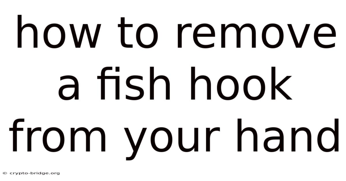 How To Remove A Fish Hook From Your Hand