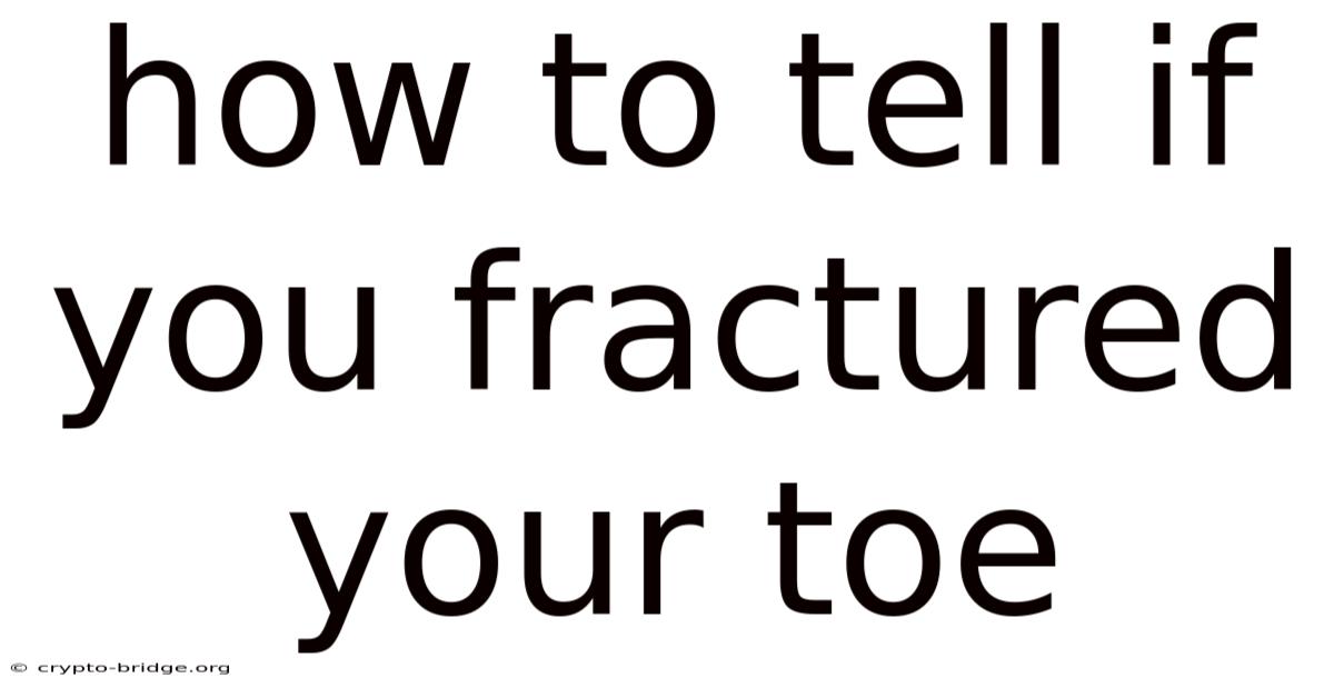How To Tell If You Fractured Your Toe