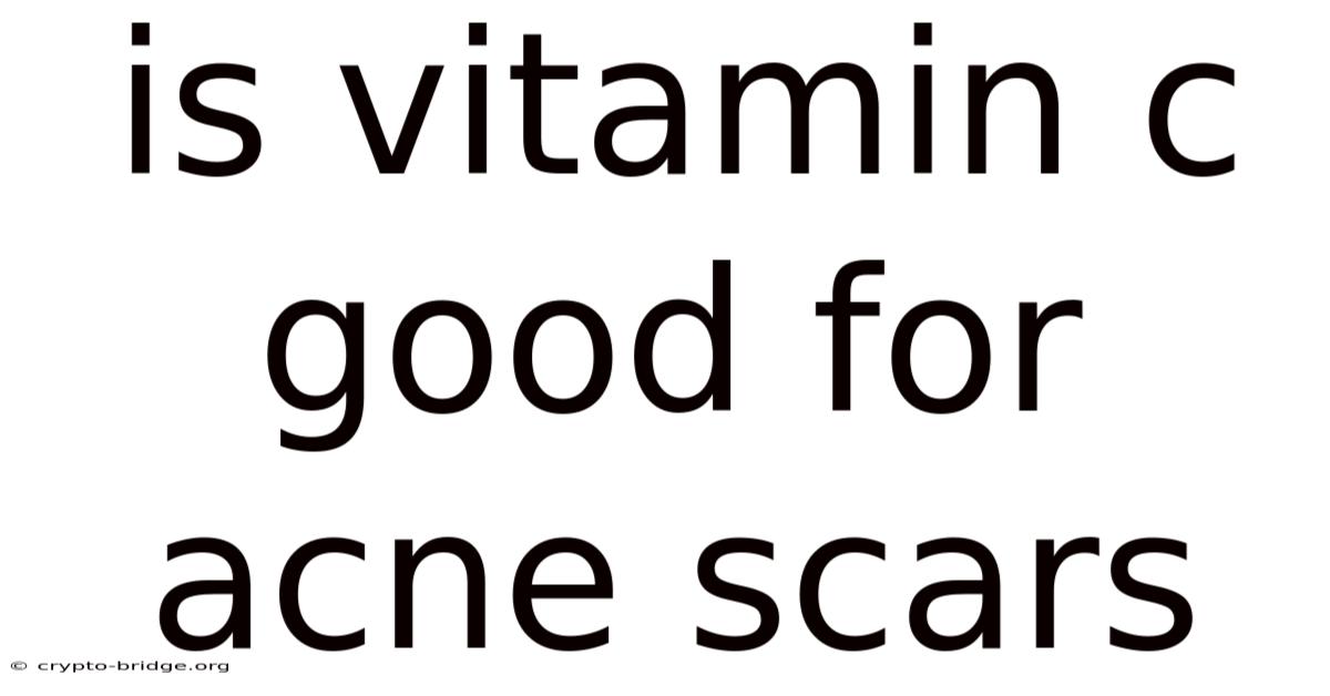 Is Vitamin C Good For Acne Scars
