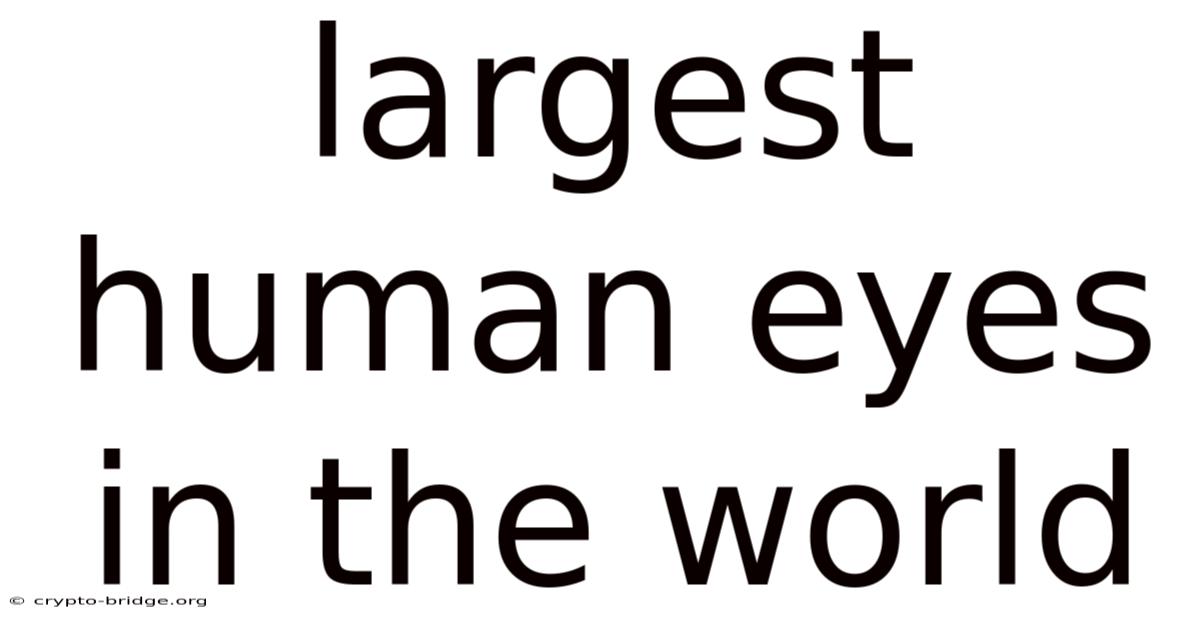 Largest Human Eyes In The World