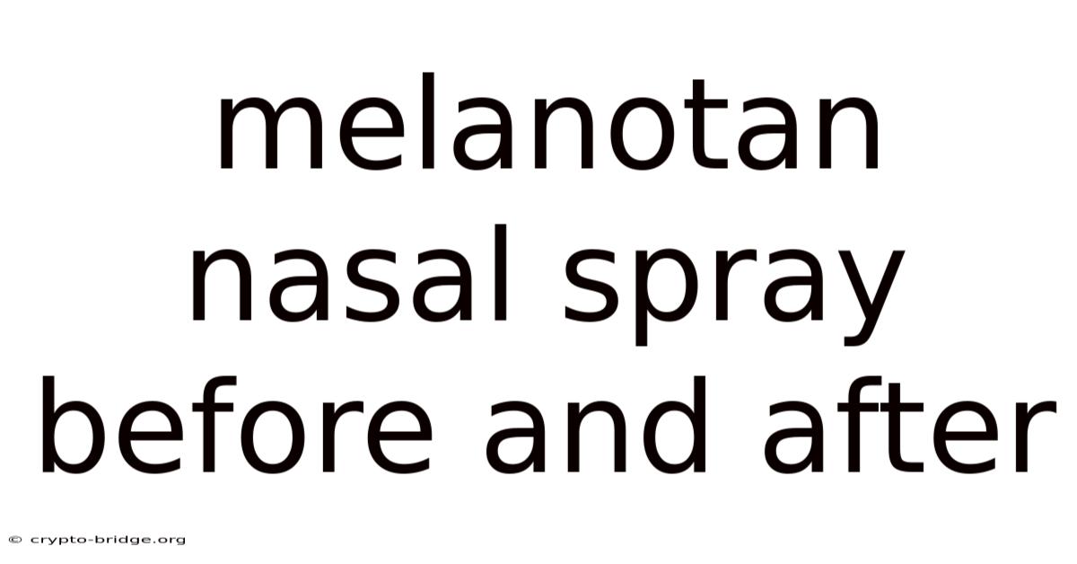 Melanotan Nasal Spray Before And After