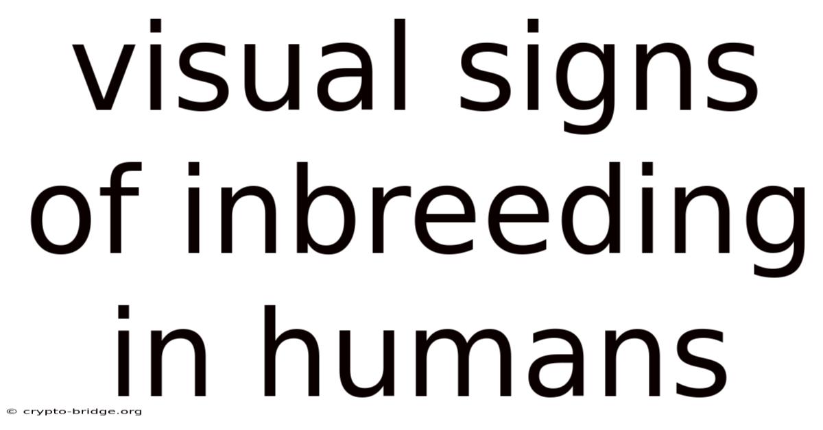 Visual Signs Of Inbreeding In Humans