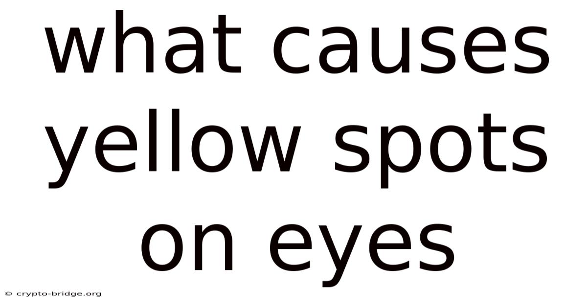 What Causes Yellow Spots On Eyes
