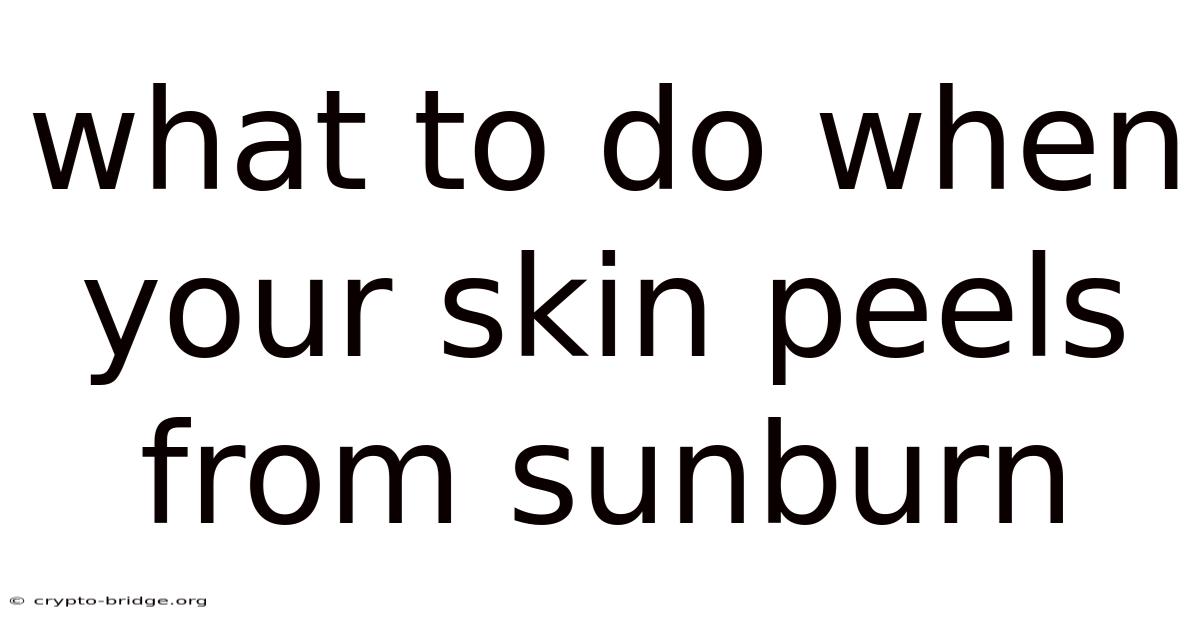 What To Do When Your Skin Peels From Sunburn