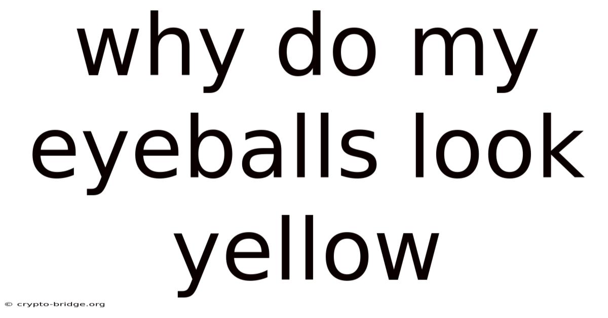 Why Do My Eyeballs Look Yellow