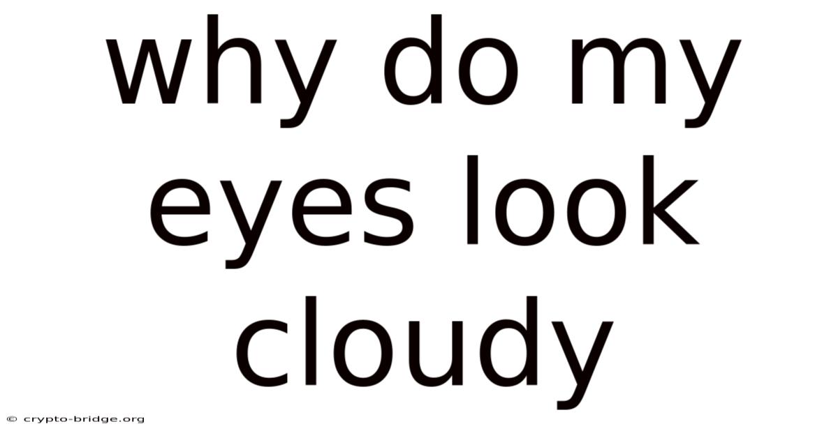 Why Do My Eyes Look Cloudy