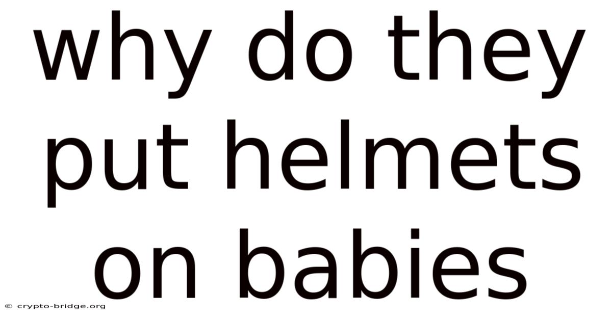 Why Do They Put Helmets On Babies
